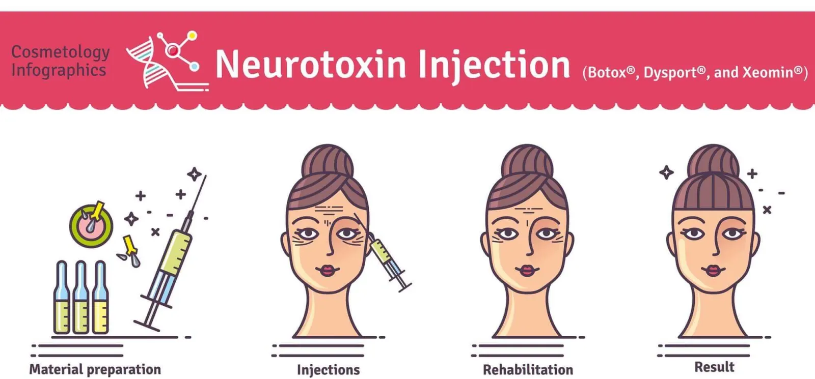 Botox Diagram