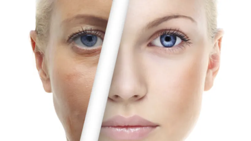 Microneedling med