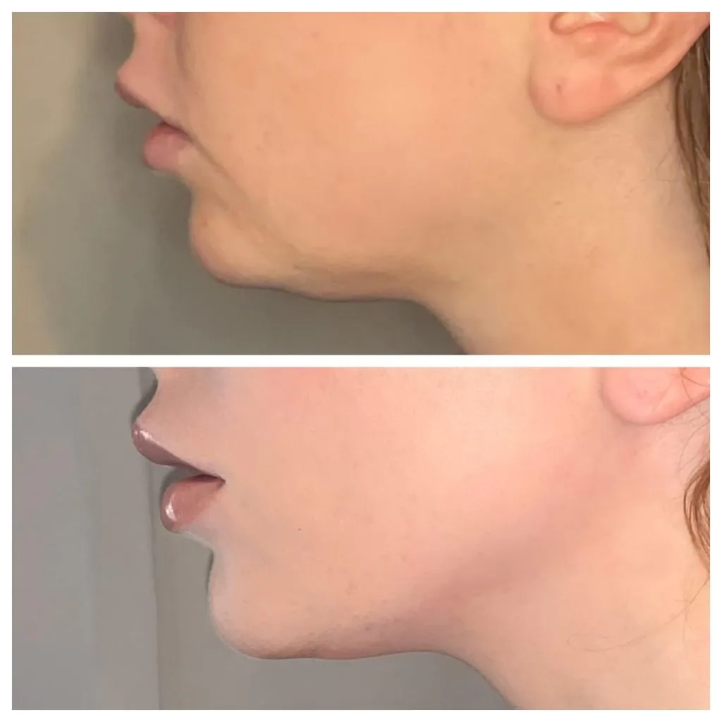 medspa 3