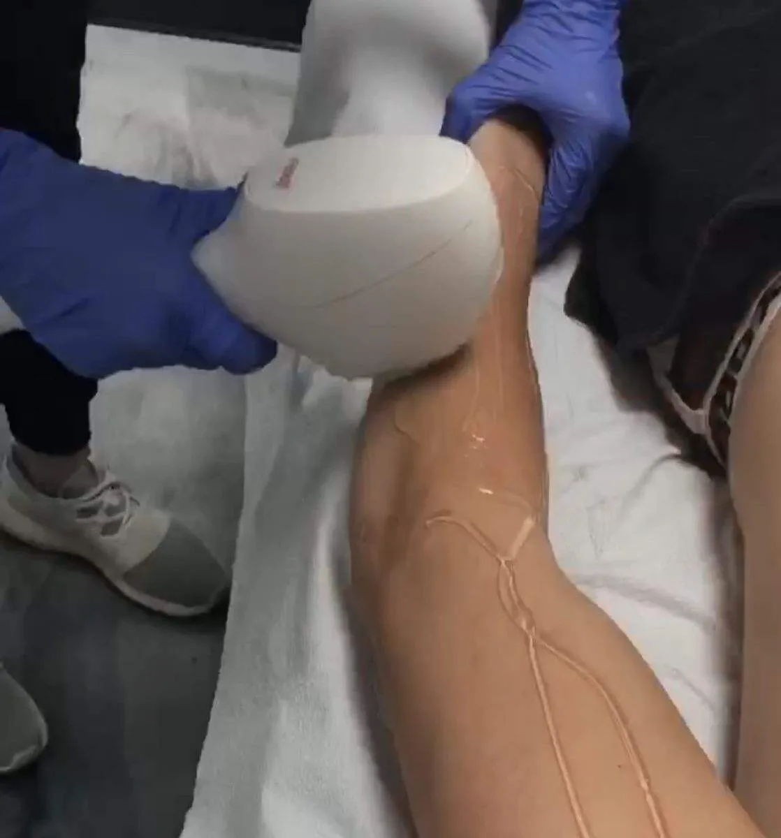 laser hair removal feature e1603306039866