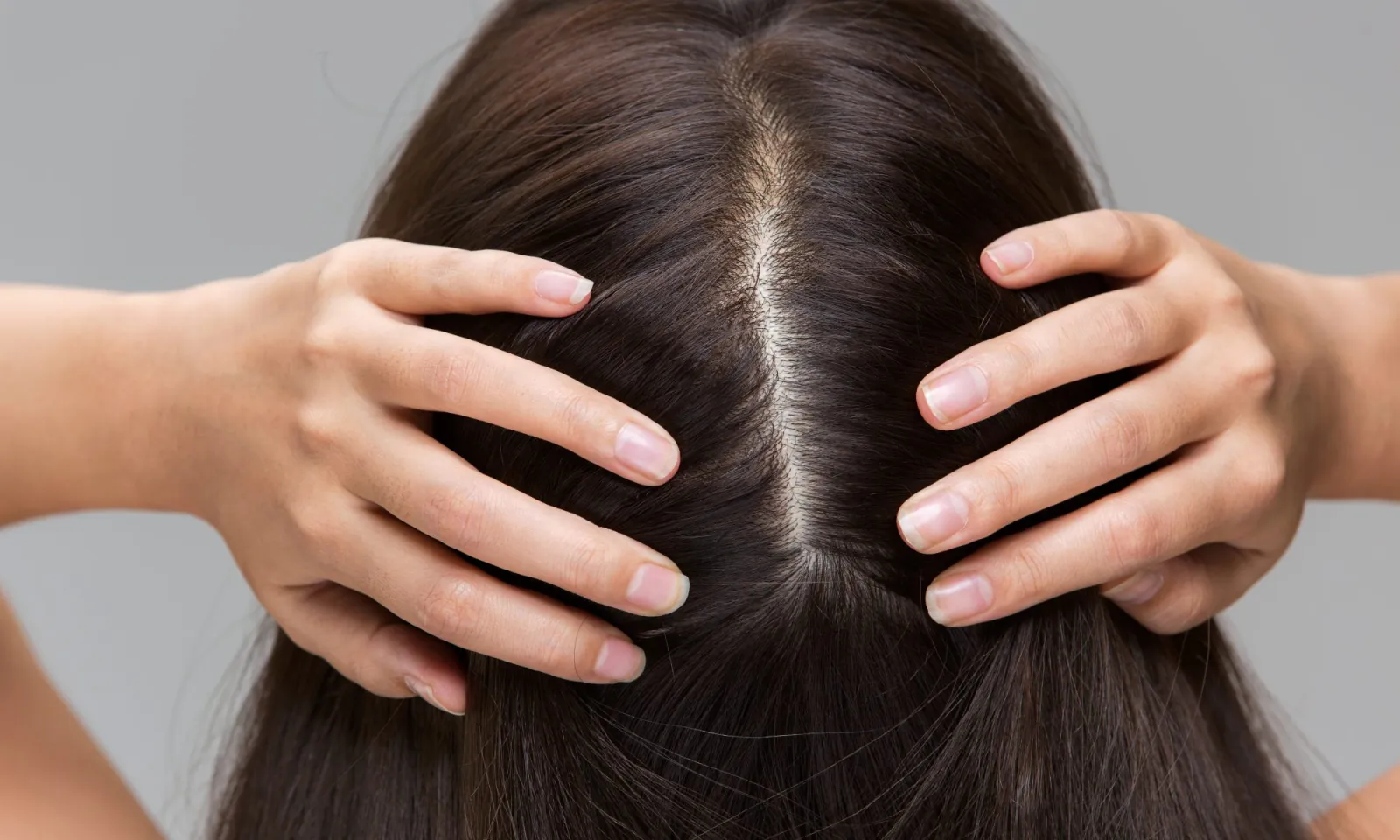 best treatments for healthy scalp scaled
