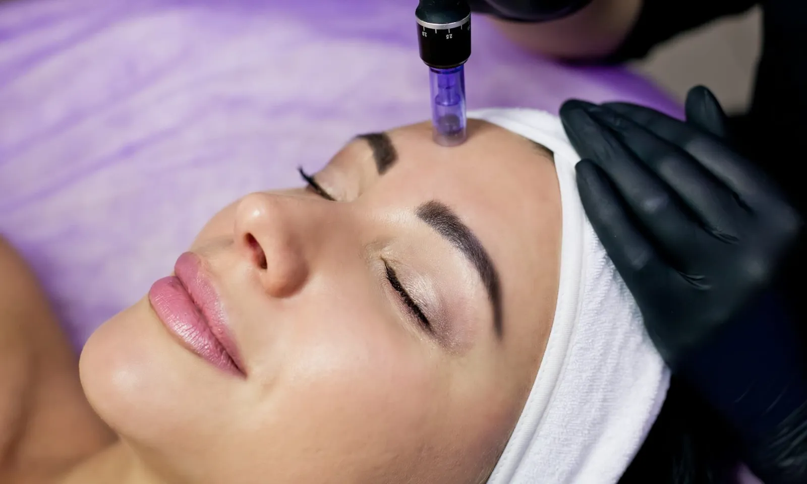 FocalPointSalonSummerGreatTimeForMicroneedling