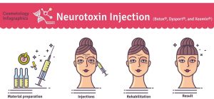 Botox Diagram