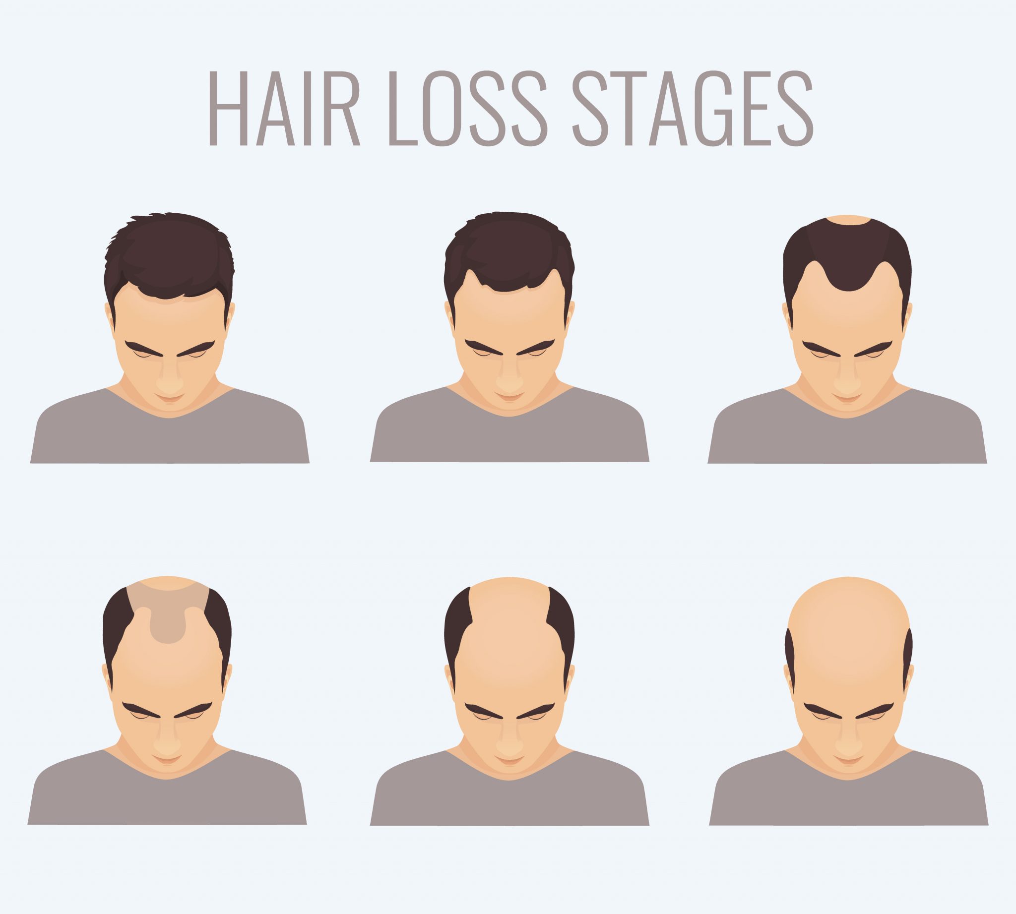 what causes hair loss