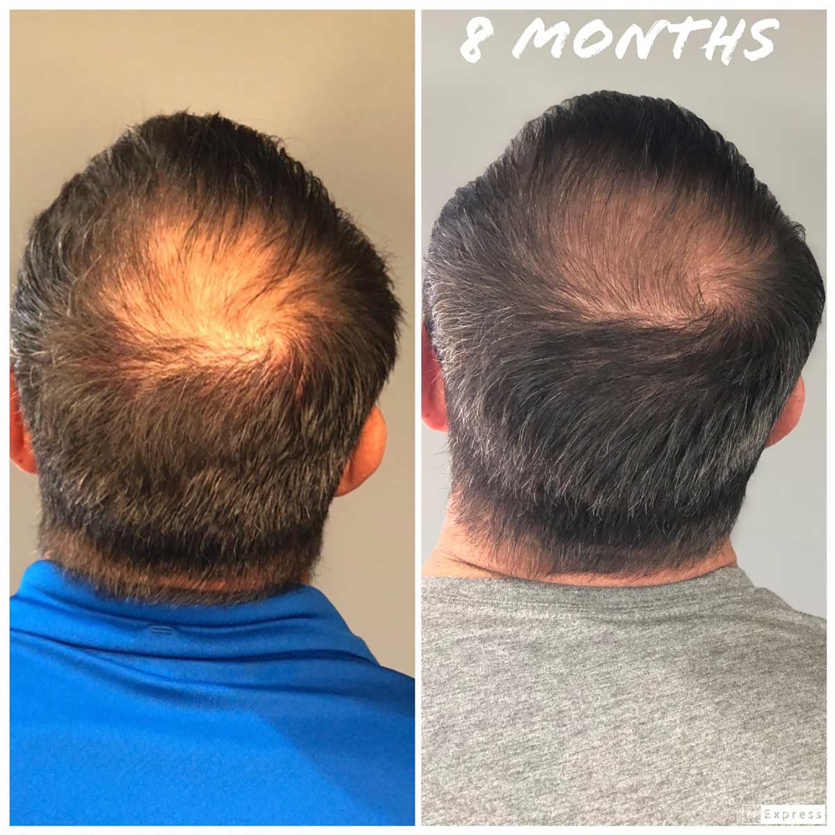 Head Spa Scalp Treatments Phoenix & Scottsdale Focal Point Salon & Spa